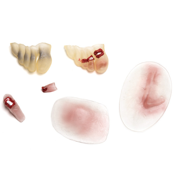 Paleta 3 - Złamania i urazy